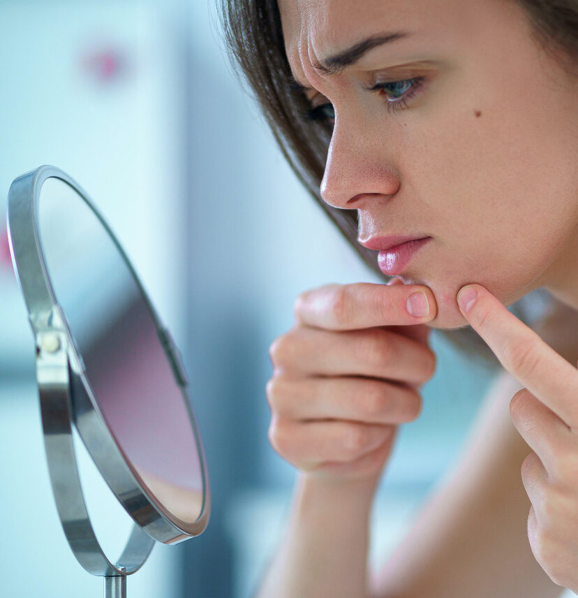 Photo of a woman squeezing a pimple on her chin