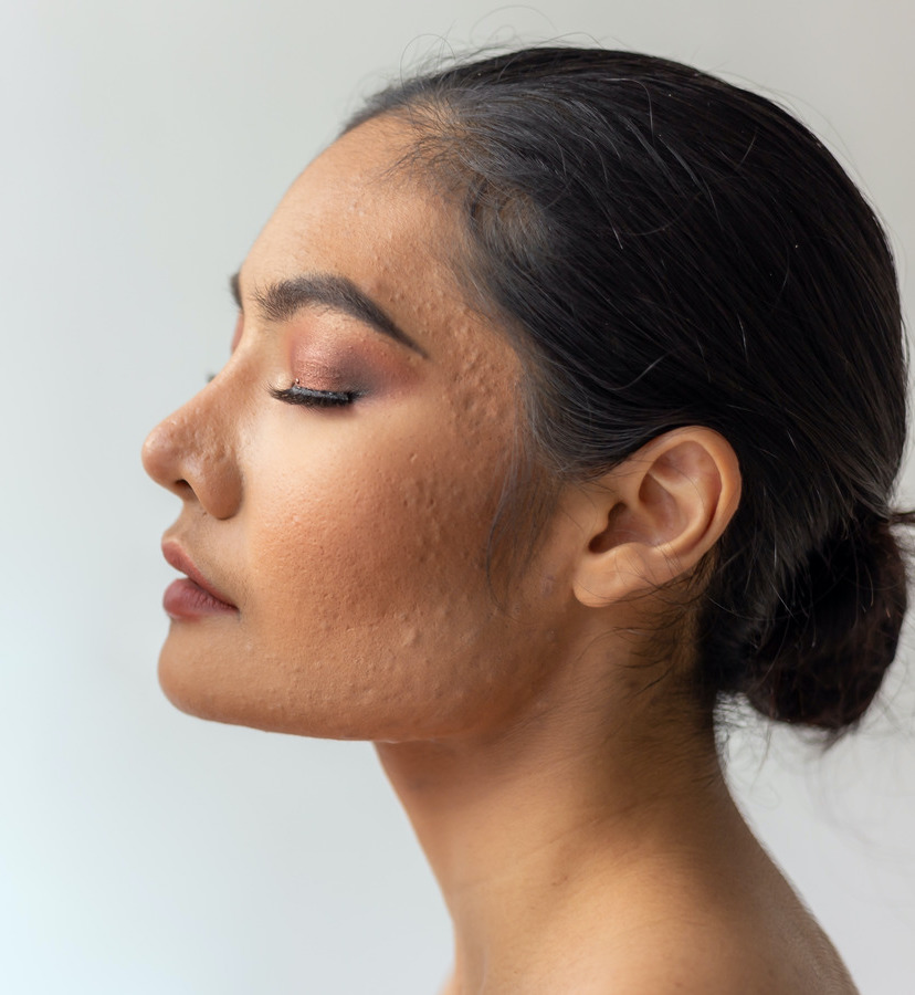 Photo of a woman with scars on her face