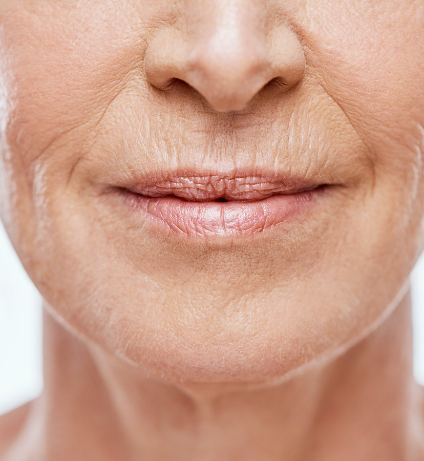 Photo of fine lines and wrinkles around an older woman's mouth