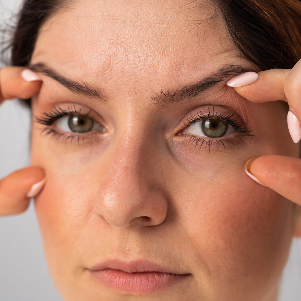 Photo of a woman trying to smooth out the skin around her eyes