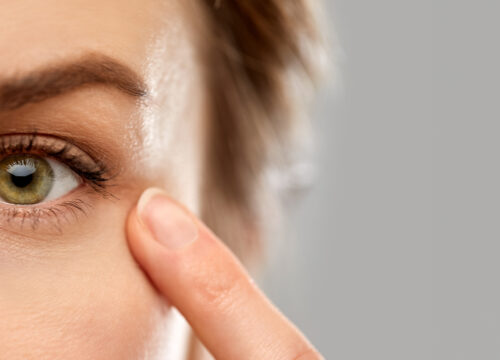 Photo of a woman experiencing eyelid laxity