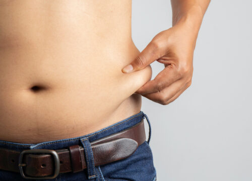 Photo of a man pinching the stubborn fat on the side of his body